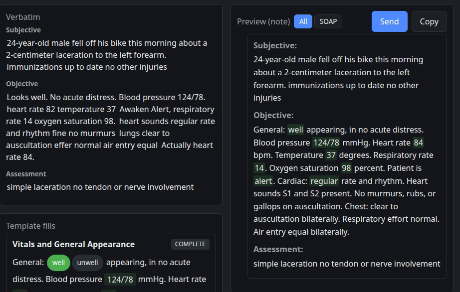The Verbatim panel of recognized speech beside the assembled note preview, with extracted values highlighted in the note